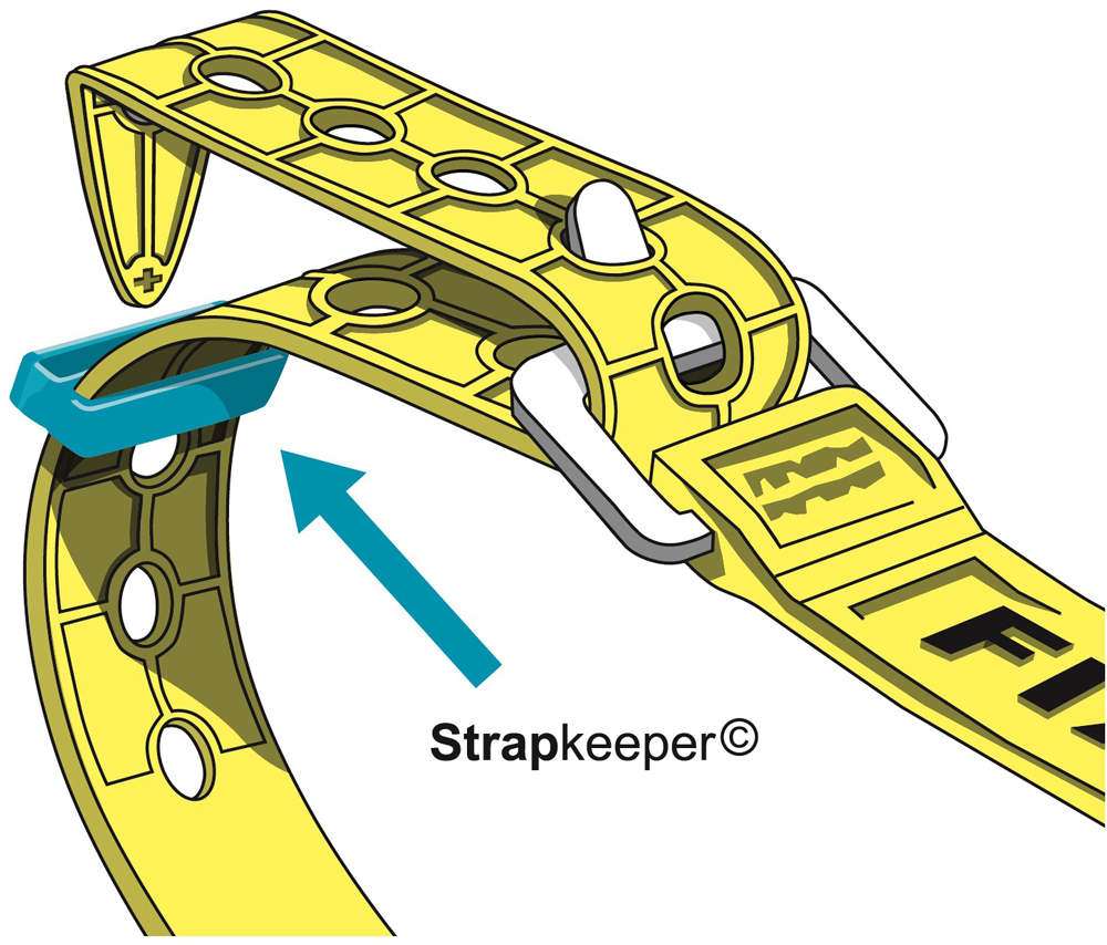 fixplus Strapkeeper für Strap Befestigungsband (4-er Pack) 3.jpg