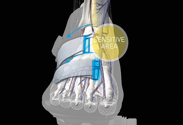 Asymmetrisches Riemendesign